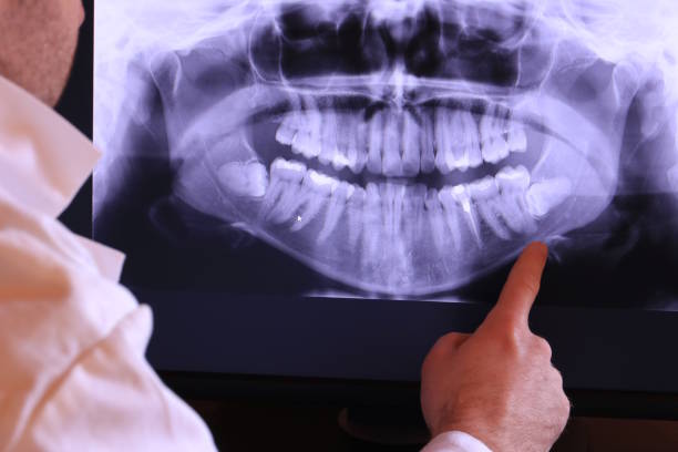 Best Emergency Denture Repair in Woodville, WI