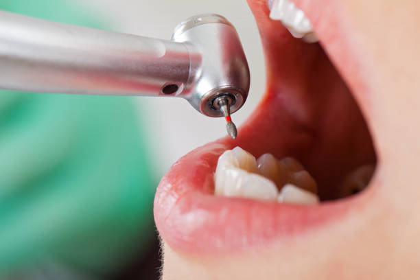 Best Emergency Dental Care for Sports Injuries in Woodville, WI